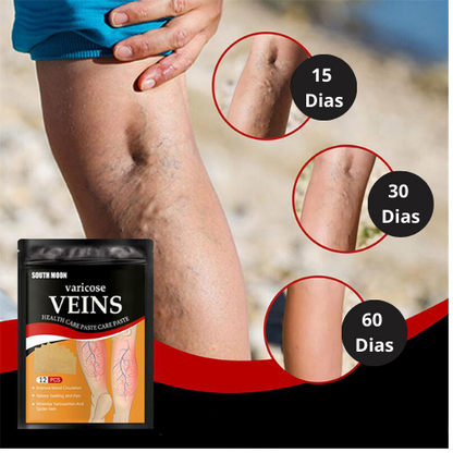 VenaSalud™-Parches para Varices 12Pcs