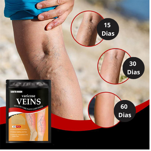 VenaSalud™-Parches para Varices 12Pcs